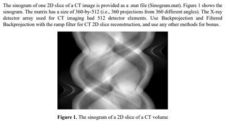 Solved The Sinogram Of One D Slice Of A Ct Image Is Chegg