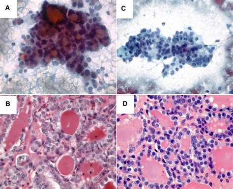 Representative Cytological Papanicolau Stain And Histological Download Scientific Diagram