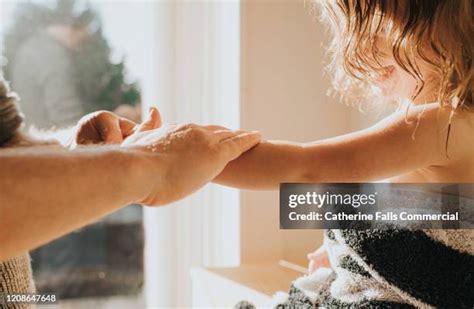 271 Psoriasis Arm Stock Photos High Res Pictures And Images Getty