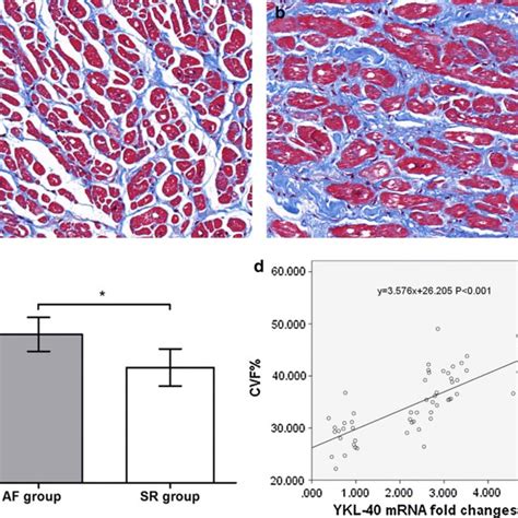 Western Blotting And Quantitative Real Time Pcr Results Of Collagen I