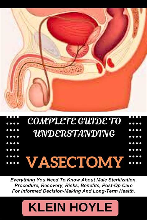 Amazon Complete Guide To Understanding Vasectomy Everything You