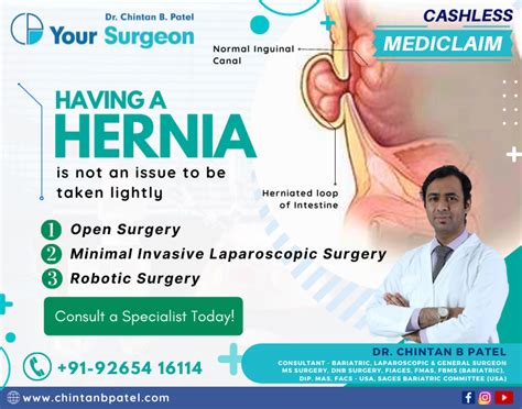 Best Hernia Treatment In Surat Dr Chintan B Patel