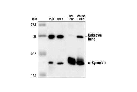 α Synuclein Antibody Cell Signaling Technology