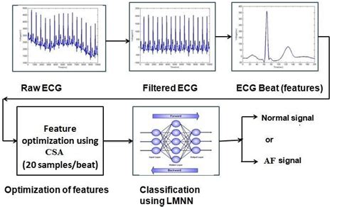 Ecg Classification Using Csa Features Download Scientific Diagram