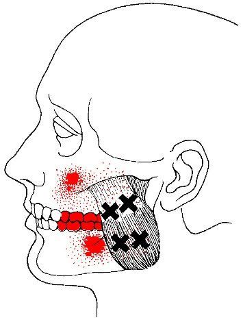 Muscle Exercises: Masseter Muscle Exercises