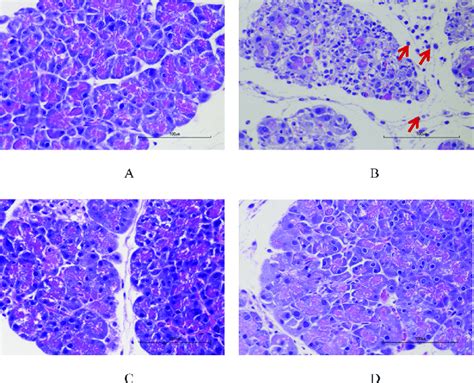 Representative Images Of Pancreatic Histopathology By H E Staining