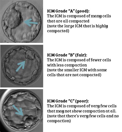 Embryo grading for Day 3 & Day 5 embryos: your questions answered