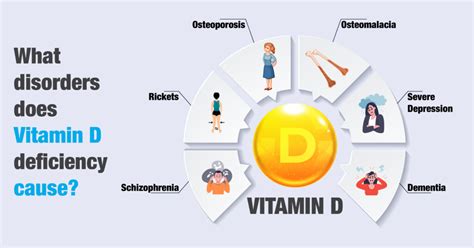 What Are The Signs And Symptoms Of Vitamin D Deficiency Matrix Pharma