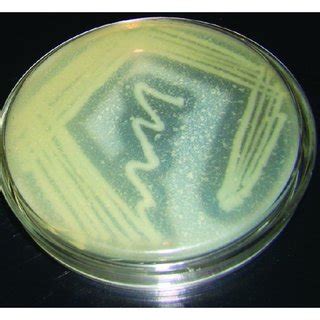 A Casein Agar Plate Showing Production Of Protease By P Aeruginosa