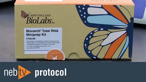 Monarch® Total Rna Miniprep Kit Neb