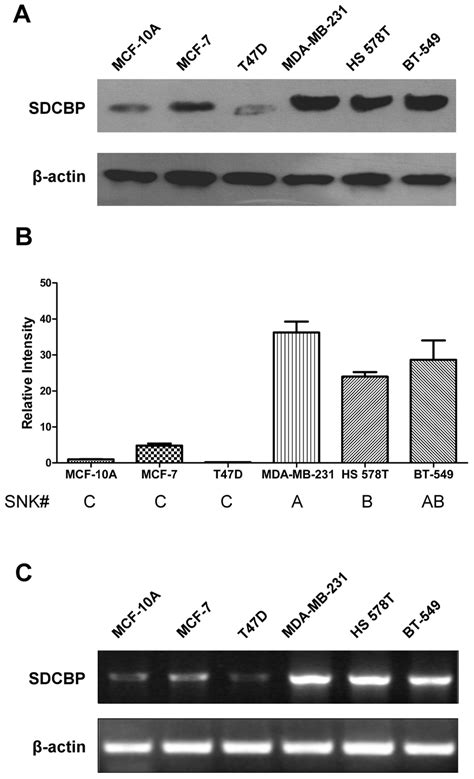 The Expression Profile Of SDCBP In Mammary Epithelial Cells A