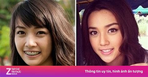 Hot girl Thái Lan đổi đời nhờ phẫu thuật thẩm mỹ Gương mặt trẻ ZNEWS VN