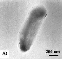 Shewanella algae - microbewiki