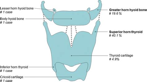 The Hyoid Bone Structure Attachments TeachMeAnatomy