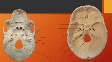 Skull Foramina Diagram Quizlet