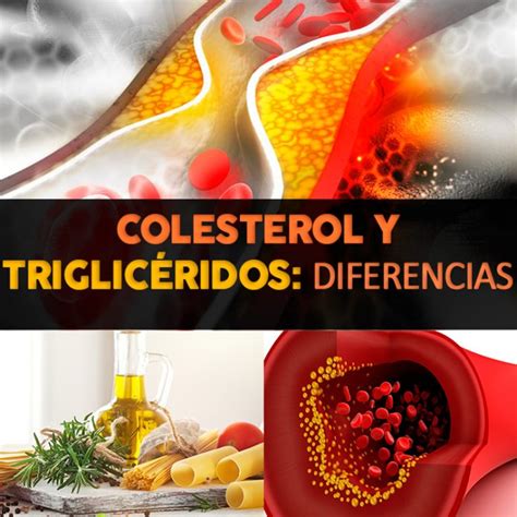 Colesterol Y Triglicéridos La Guía De Las Vitaminas