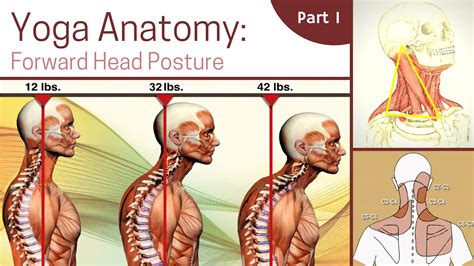 Forward Head Posture