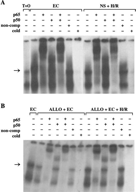 Supershift Analysis Of NF B Nuclear Translocation In The EC And NS H R