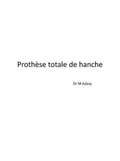 Prothèse totale de hanche CHU Limoges proth 232 se totale de hanche