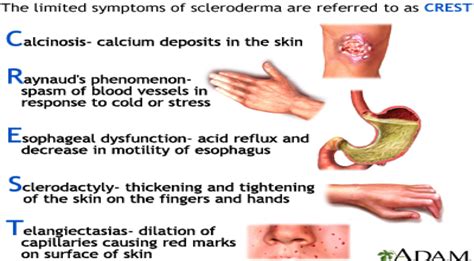 what is crest disease Crest syndrome: medlineplus medical encyclopedia ...