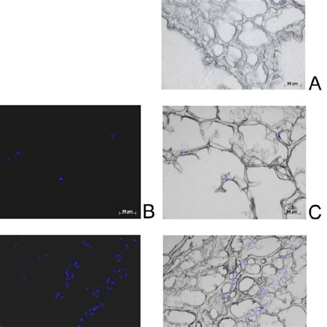 Human Nucleus Pulposus Like Cells Were Seeded Onto Pu Spheroids The Download Scientific