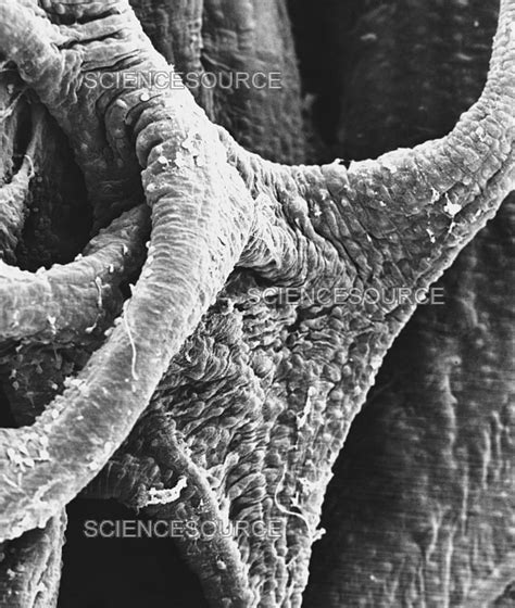 Photograph Chordae Tendinae SEM Science Source Images