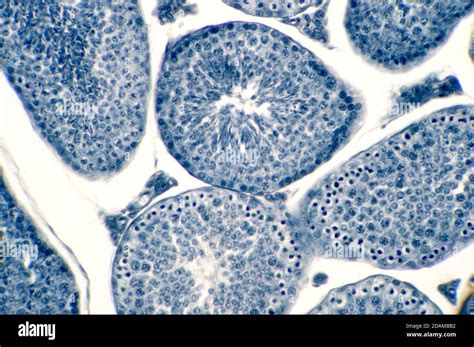 Human Testis Light Micrograph Seen Here Are Spermatogonia