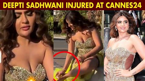 Deepti Sadhwani Cannes 2024 Deepti Sadhwani Leg Injured During Walk