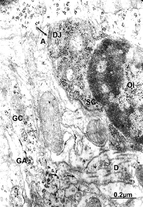 Mouse Cerebellar Granular Layer Notably Swollen Granule Cell Gc