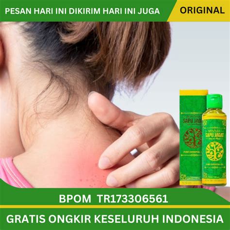 Jual Obat Biang Keringat Obat Gatal Gatal Obat Gatal Biang Keringat