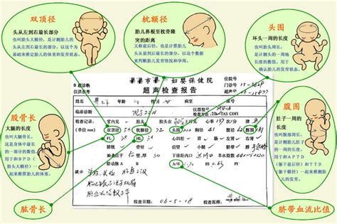 就三分钟，手把手教你看懂b超单 知乎