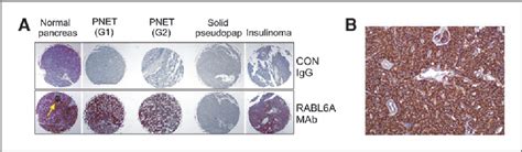 Figure From Tumor And Stem Cell Biology Rabl A Promotes G S