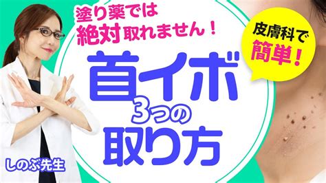 【皮膚科で簡単 首イボの3つの取り方 】皮膚科でキレイになりますよ、塗り薬では絶対に取れません！ Youtube