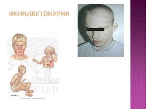 Клиника интеллектуальных нарушений. Общие принципы диагностики ...