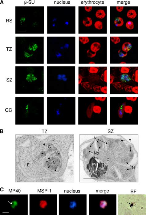 Subcellular Localization Of Su Type In The P Falciparum Blood