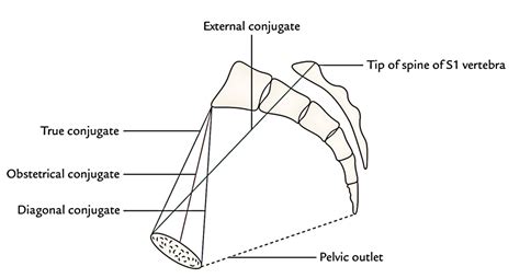 True Pelvis Anatomy