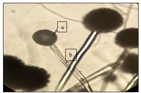 Aspergillus Fumigatus Facesoffungi Number Fof 10086 Faces Of Fungi