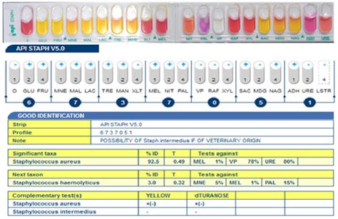 Table From Isolation And Identification Of Biofilm Forming