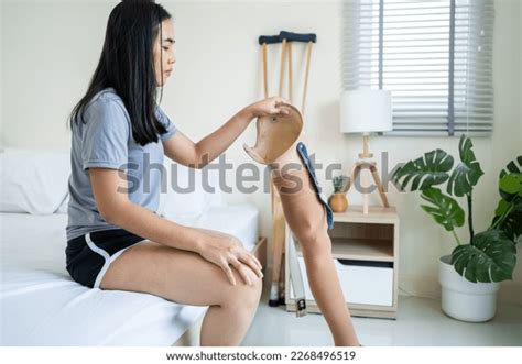 Asian Young Amputee Woman Wearing Prosthetic ภาพสต็อก 2268496519