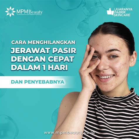 Cara Menghilangkan Jerawat Pasir Dengan Cepat Dalam Hari Dan