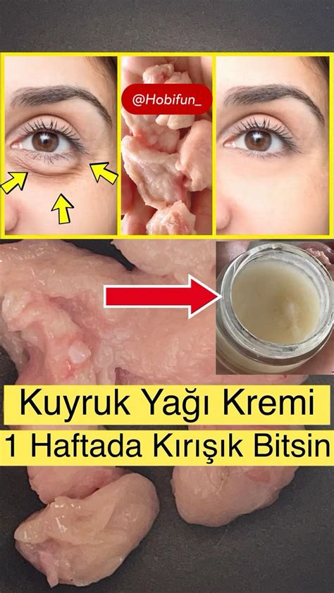 Kuyruk Ya Kremi Ile Haftada Kiri Iklik Bitsinremove Wrinkles In