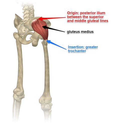 IM Injection Gluteus Medius