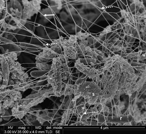 Dental plaque under a microscope : r/interestingasfuck