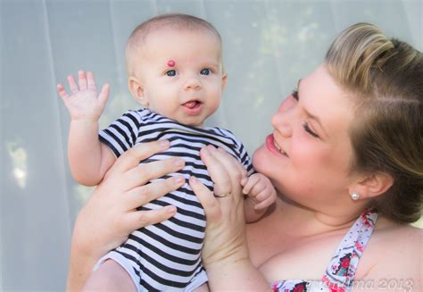 Mongolian Blue Spots, Stork Bites, & Other Birthmarks | Rebecca