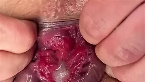 Mis Grandes Agujeros Anal Gape XHamster