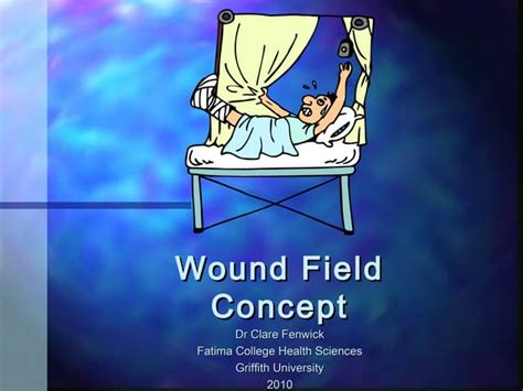 wound field concept ad