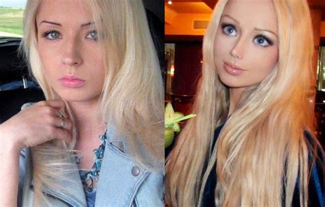 Human Barbie Before And After Plastic Surgery Valeriya Lukyanova Mommy Makeover Plastic