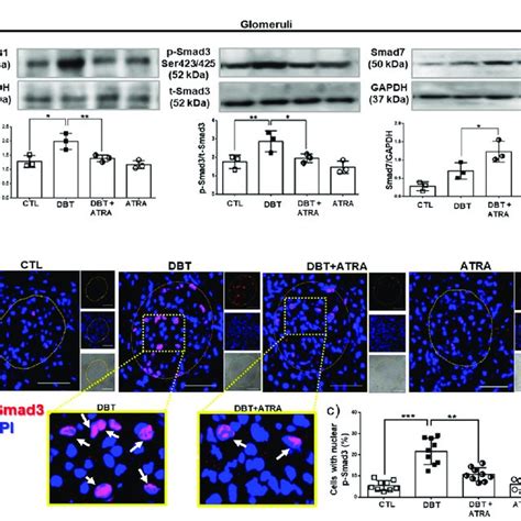 All Trans Retinoic Acid Atra Blocked Activation Of Transforming