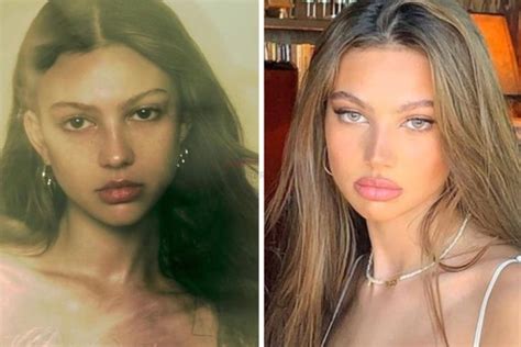 The Truth About Rachel Fuda Plastic Surgery Nose Job And Rhinoplasty