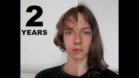 2 Years Hair Growth Time Lapse Youtube